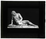 Musée du Capitole à Rome (Italie), "Le Gaulois mourant".